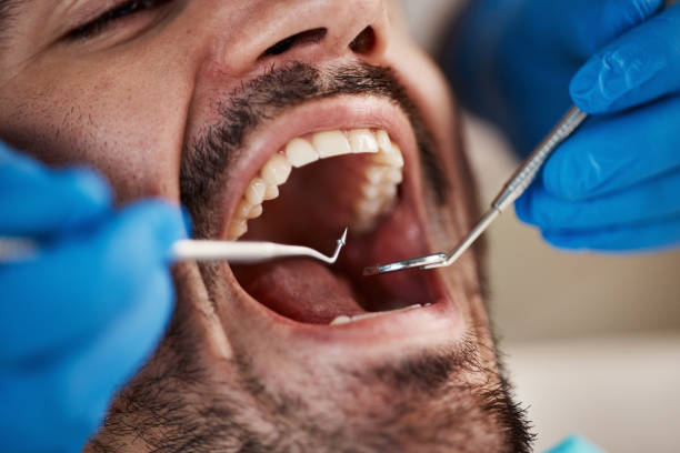 Best Emergency Dental Care for Broken or Chipped Teeth in Fox Crossing, WI